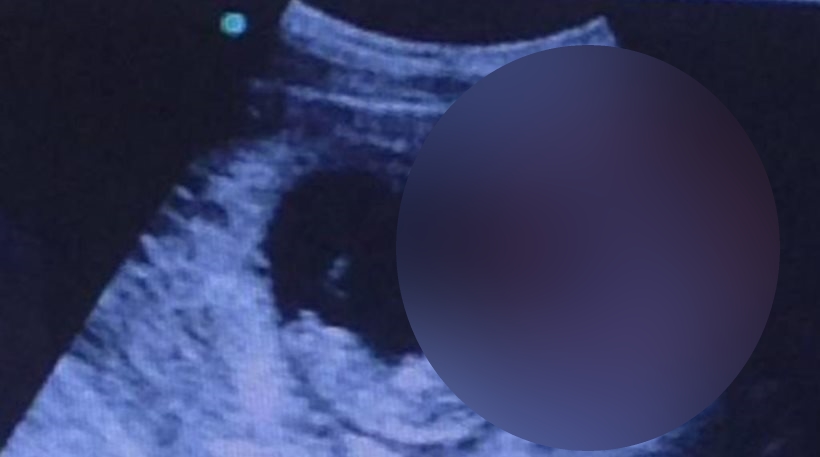 ImageHxxxxxandler sunf(2)