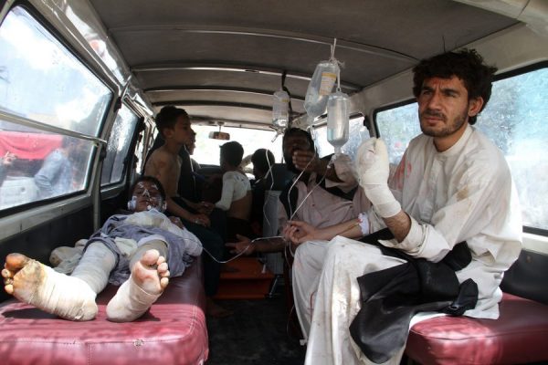 epa05294356 An Afghan boy, who was injured in a road accident, is brought to local hospital in Ghazni, Afghanistan, 08 May 2016. Fifty-two people were killed and at least 73 injured when two buses collided with a fuel tanker on 08 May in Kabul highway, an official said.  EPA/SAYED MUSTAFA