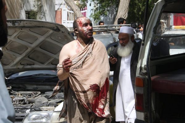 epa05294360 An Afghan man who was injured in a road accident, is brought to local hospital in Ghazni, Afghanistan, 08 May 2016.   Fifty-two people were killed and at least 73 injured when two buses collided with a fuel tanker on 08 May in Kabul highway, an official said.  EPA/SAYED MUSTAFA ATTENTION EDITORS: PICTURE CONTAINS GRAPHIC CONTENT