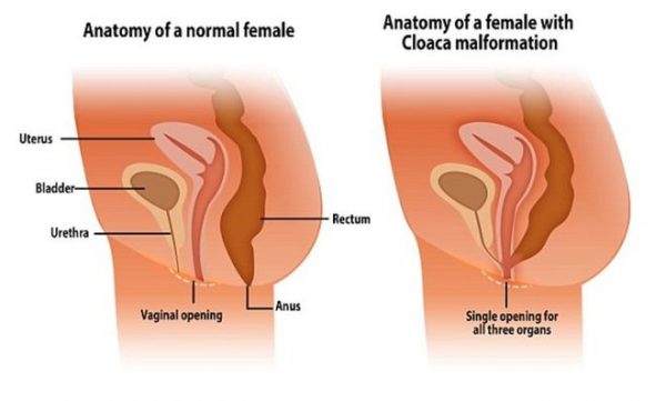 anatomy