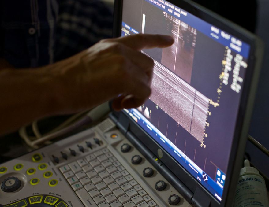 ultrasound