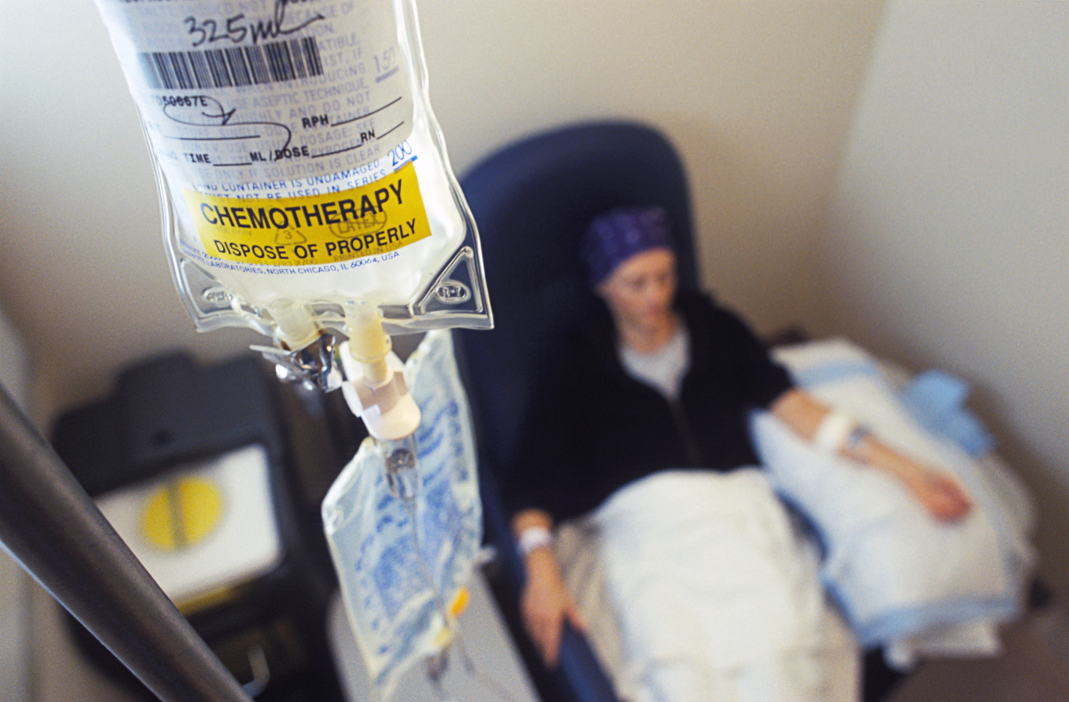 ^BMODEL RELEASED. Cancer chemotherapy.^b Female patient receiving anticancer drugs from an intravenous drip bag. This continuously supplies the patient with a controlled amount of drugs that target cancer cells. The drugs target all rapidly dividing cells, which causes them to have a range of side effects, including hair loss. Cancer is a disease caused by the uncontrolled replication of abnormal cells, which can invade and destroy healthy tissue. The drugs in use here are ^Icytoxan^i and ^Iadriamycin^i. Photographed at Massachusetts General Hospital, USA.