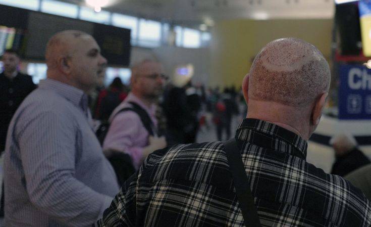 Three foreigners who underwent hair transplants wait for their flights at Ataturk Airport, Turkey, Friday, Feb. 22, 2019. Turkey has become a major destination for successful hair transplants, attracting foreigners who want hair transplants at cheap prices ( (AP Photo/Burhan Ozbilici)