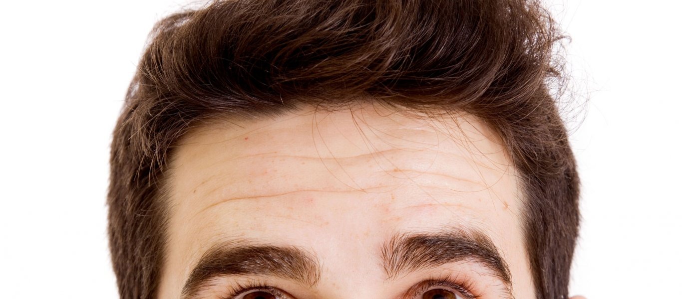 male-pattern-hair-loss-treatment