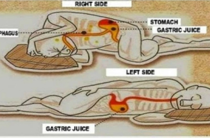 gastric