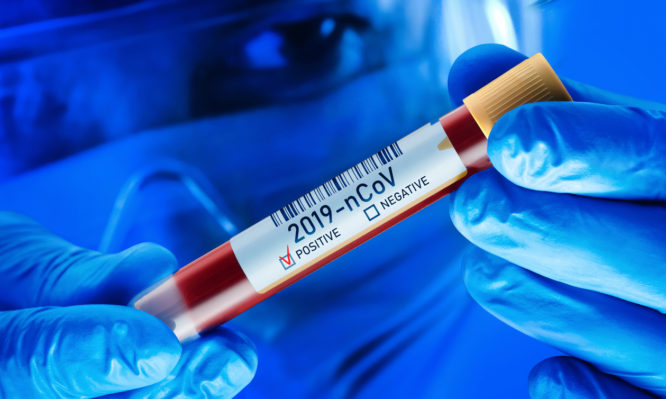Nurse holds blood test tube for 2019 nCoV analysis. Chinese Corona Virus Blood Test Concept