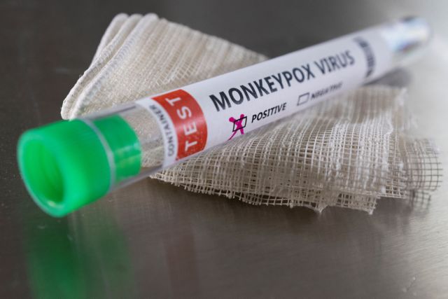 Test tube labelled "Monkeypox virus positive" are seen in this illustration taken May 22, 2022. REUTERS/Dado Ruvic/Illustration
