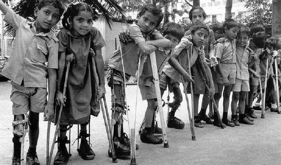 polio-in-children-720x425