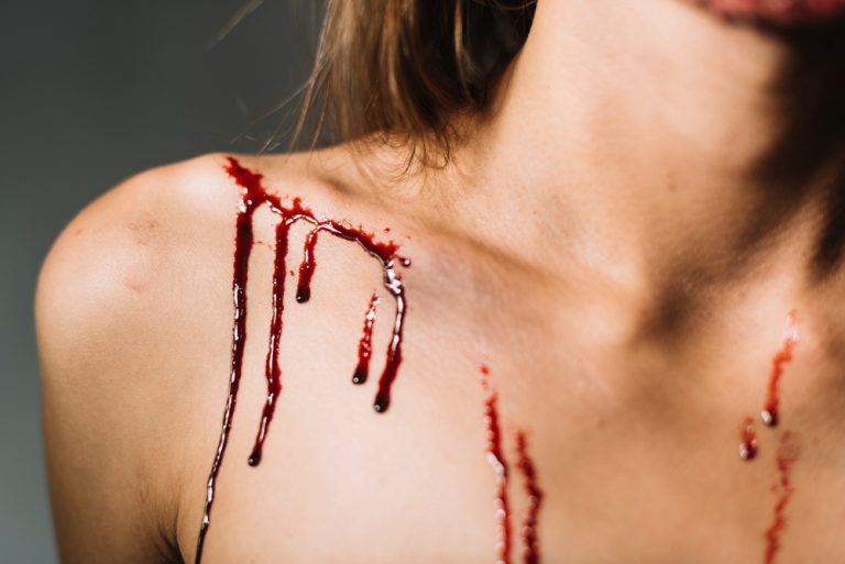 blood-spills-shoulder-young-woman